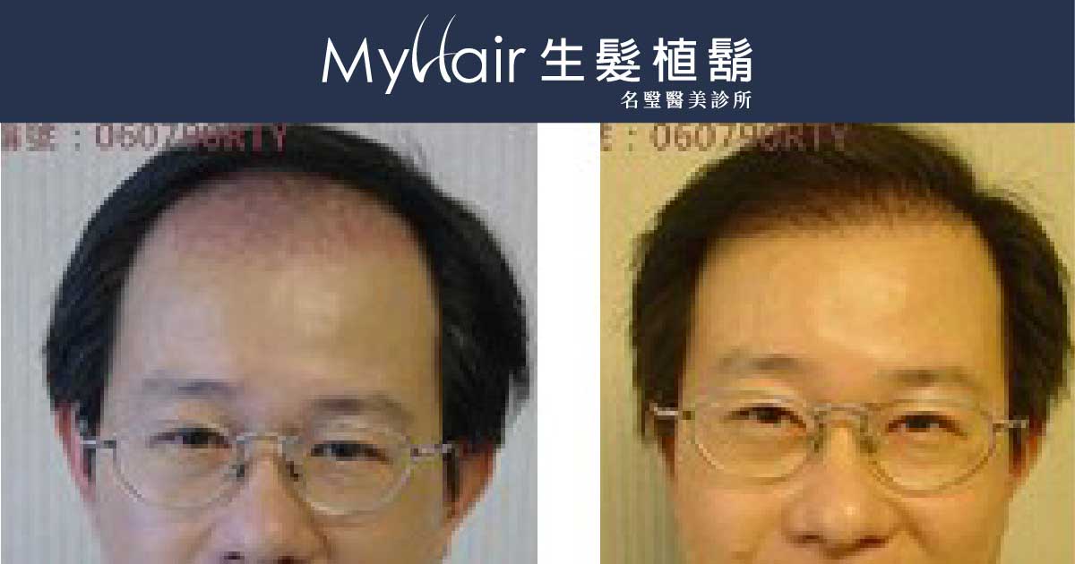 fb og img 060790RTY 1