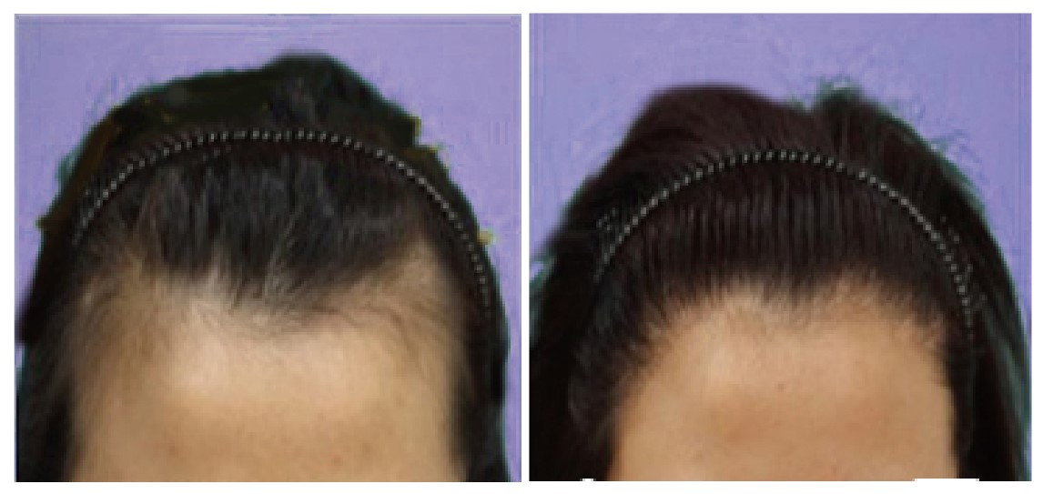 News Post 20200511a 02