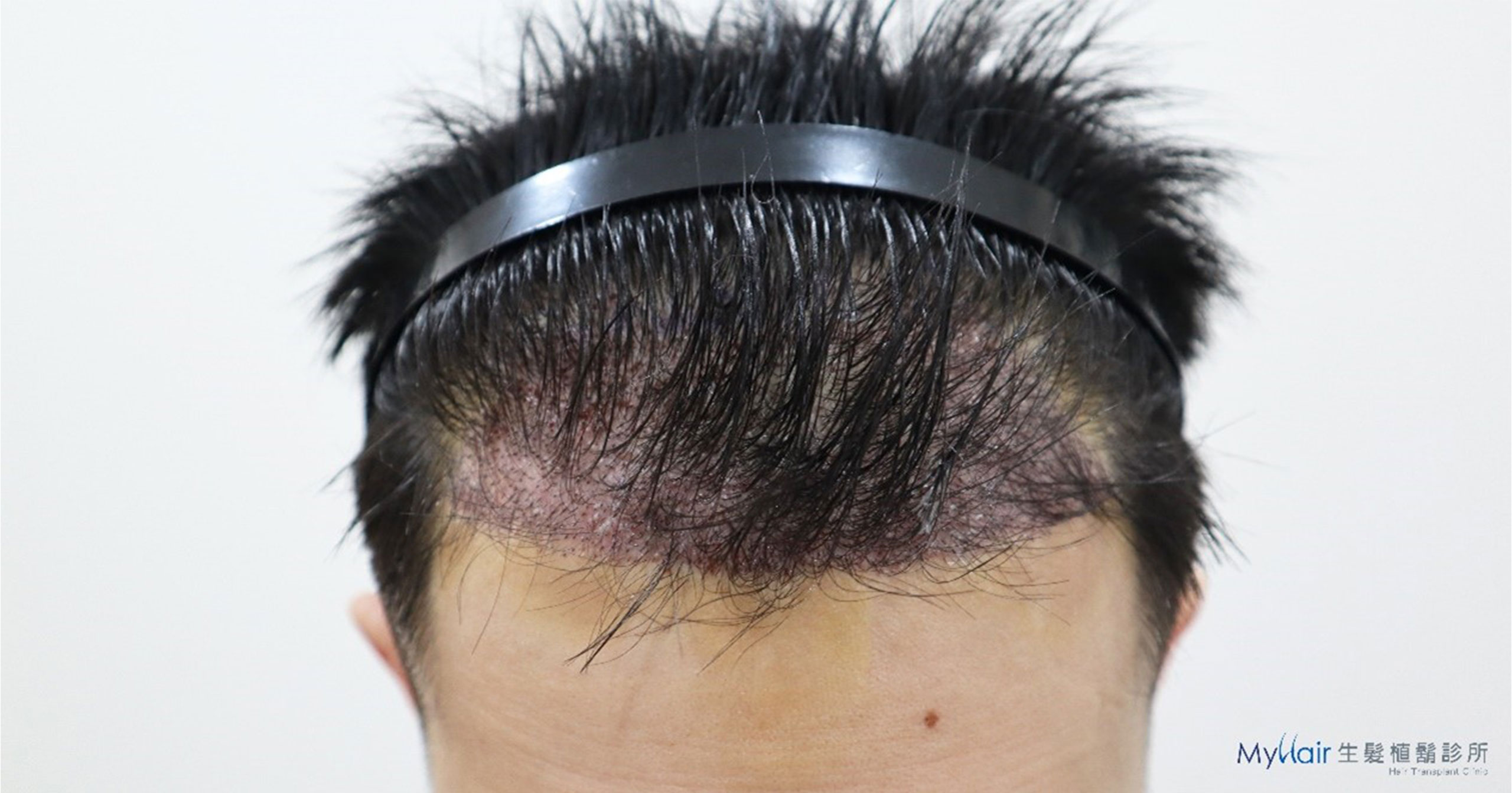 H110106WJL-03