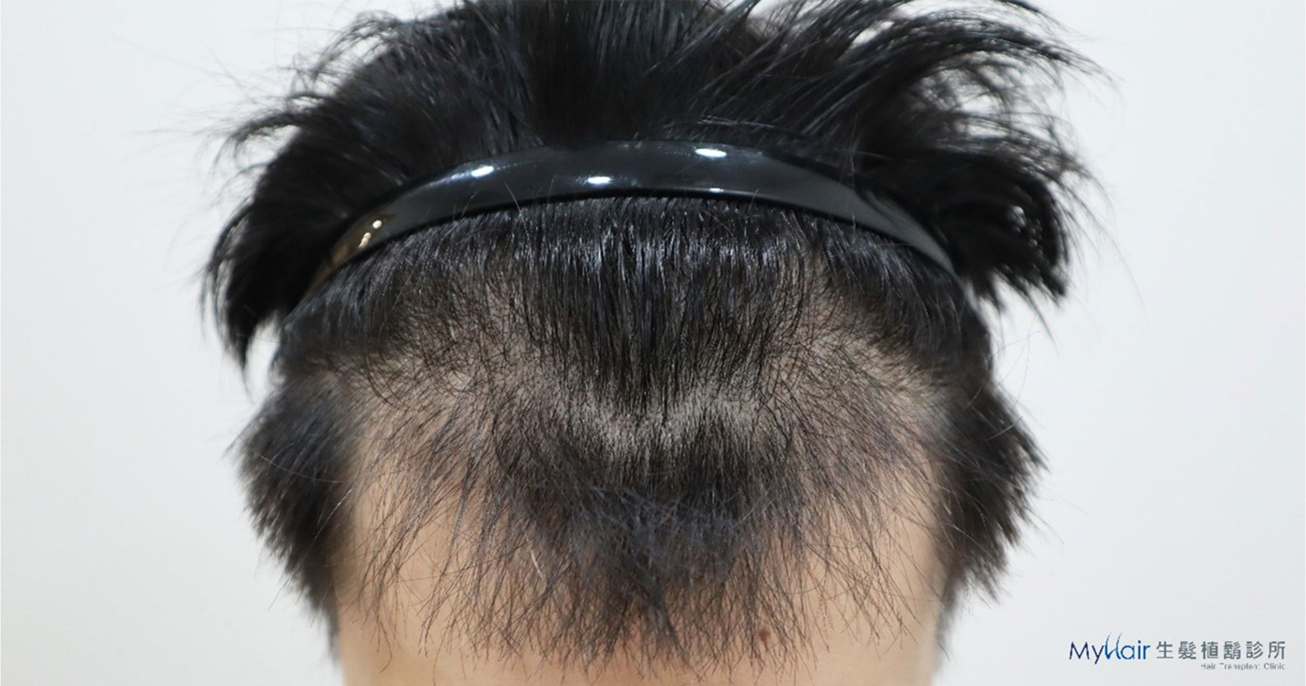 H110106WJL-04