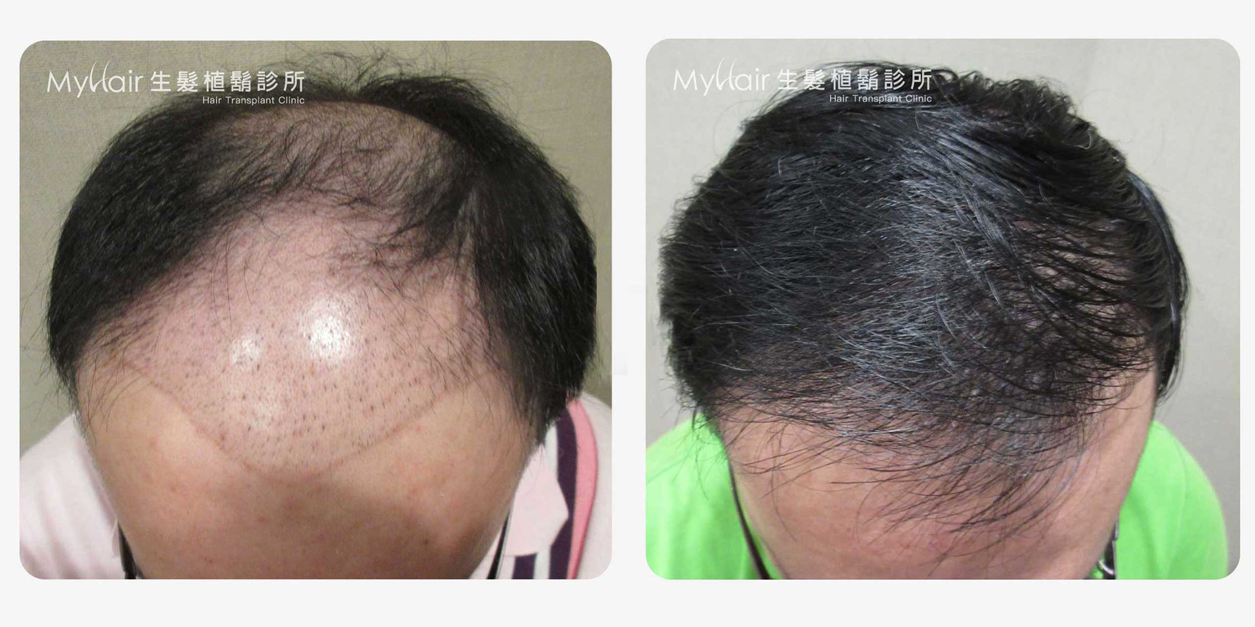 Hairhktw 03a