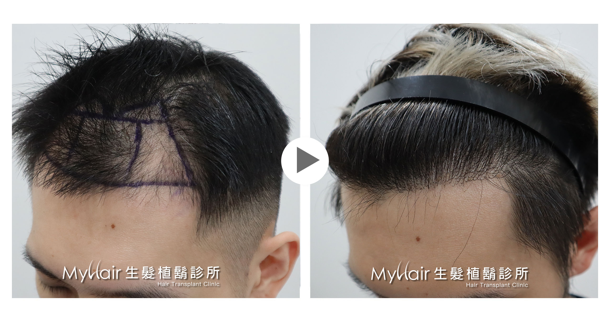 Hairhktw 05