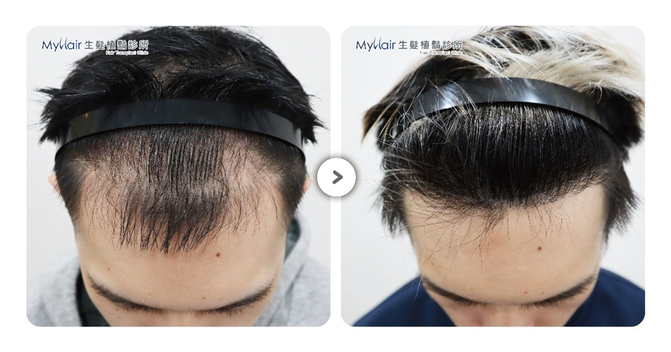 Hairprice 06