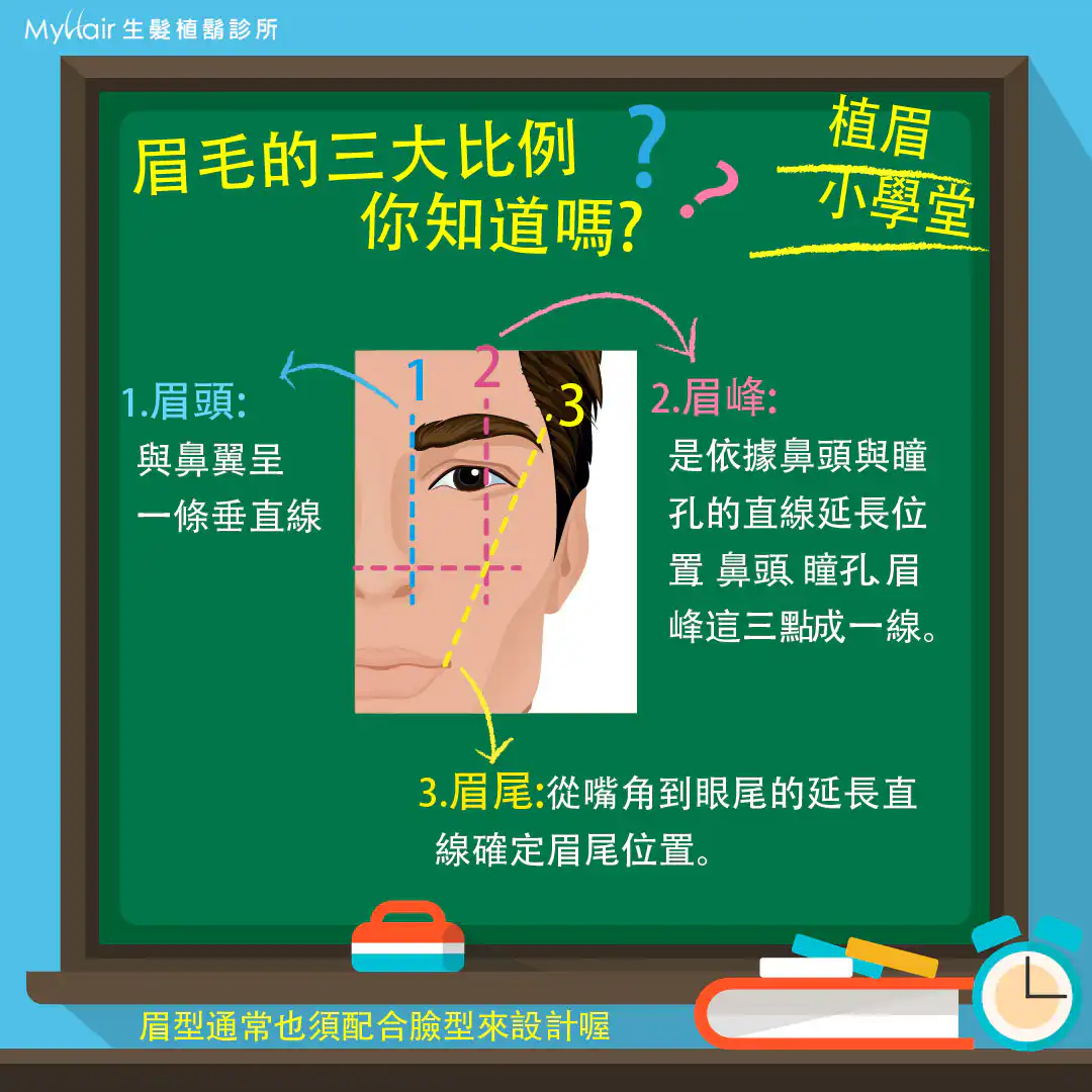 Implantation Eyebrows 02