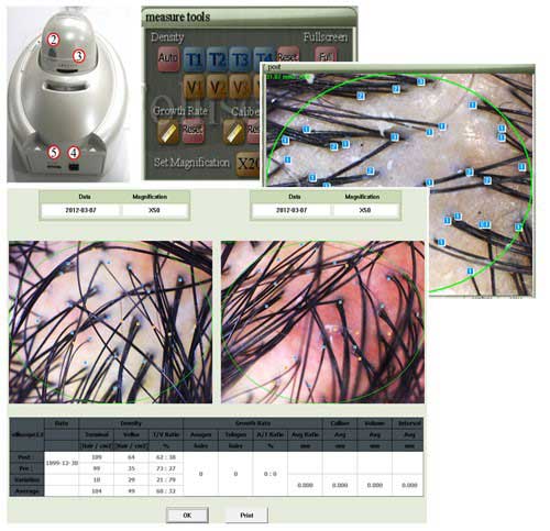 Hairless Evaluation04 1