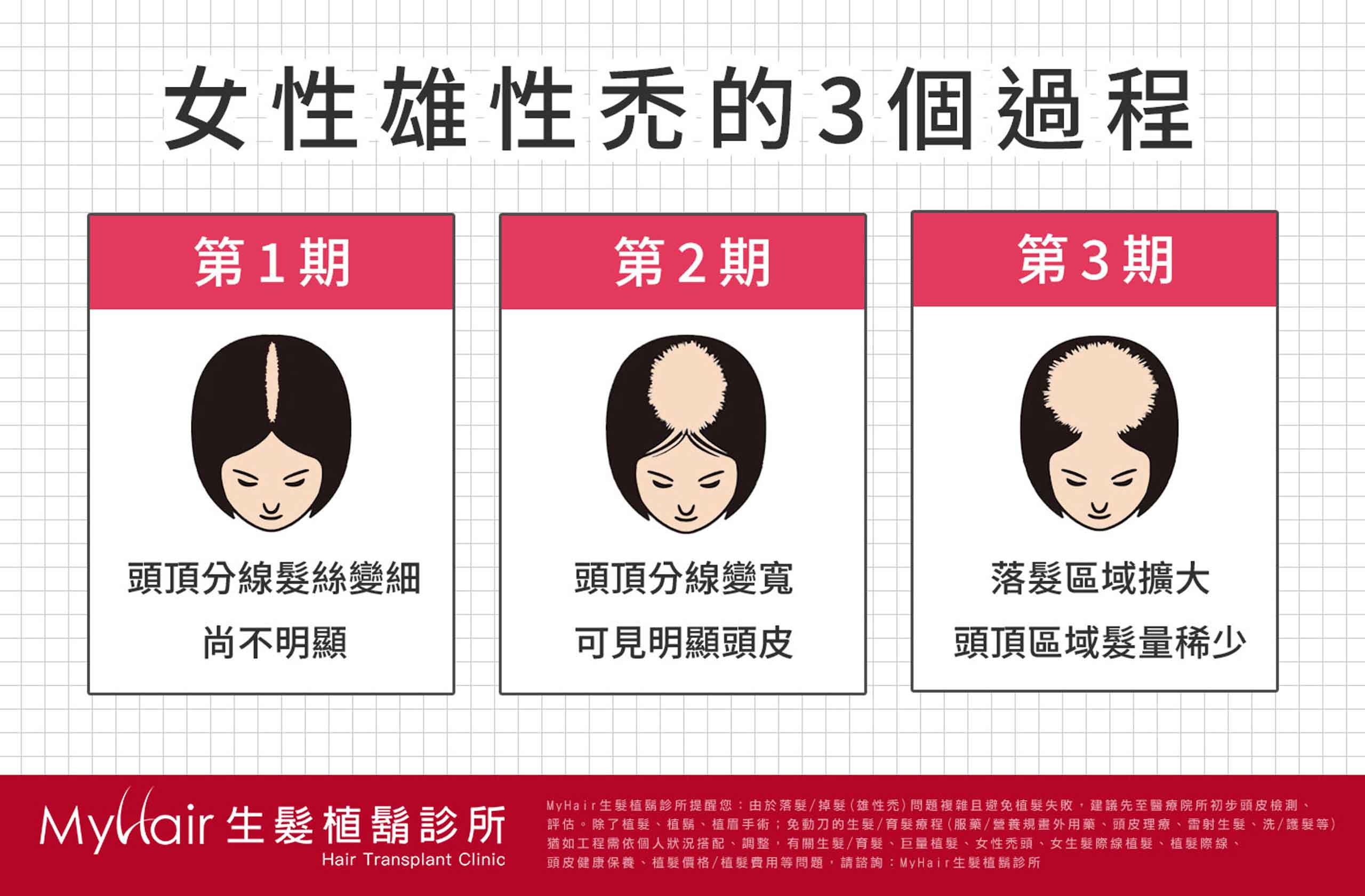 News post 20250529 04