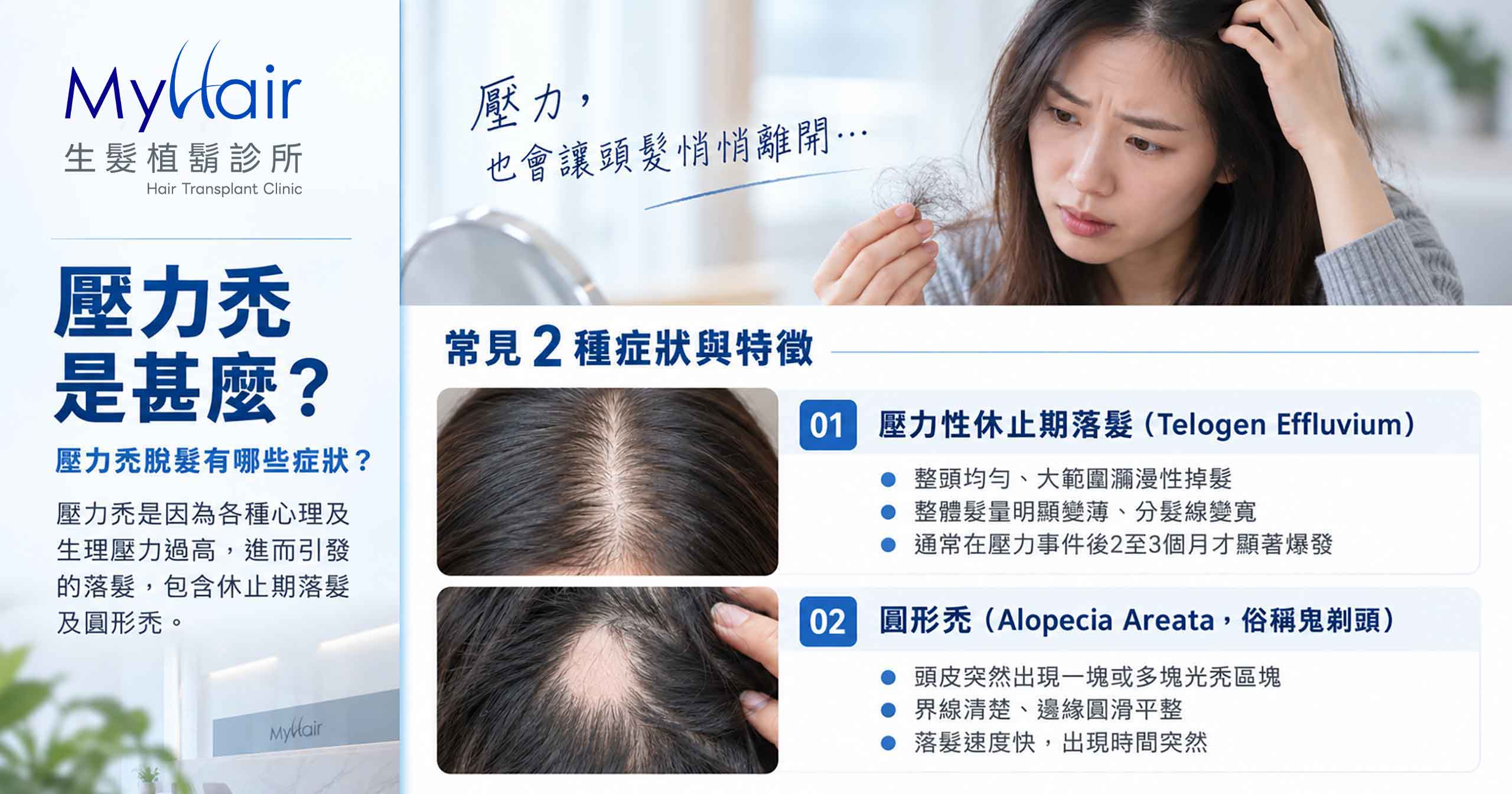 Stress related hair loss